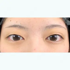 湘南美容クリニック 新宿本院 須田 陽一医師の症例