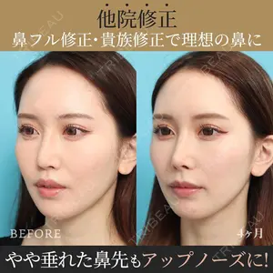 ヴェリテクリニック銀座院 藤本 雅史医師の症例