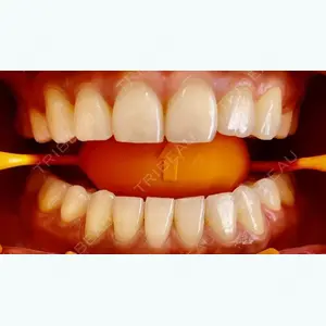 HiromiSaigusa Dental Clinic【ヒロミサイグサデンタルクリニック】 三枝 裕美医師の症例