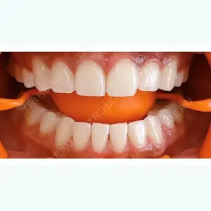 HiromiSaigusa Dental Clinic【ヒロミサイグサデンタルクリニック】 三枝 裕美医師の症例