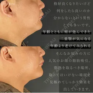 MYCLI【マイクリ】 本田マイケル武史医師の症例