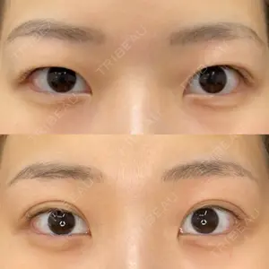 渋谷美容外科クリニック 新橋院 藏薗 侑人医師の症例