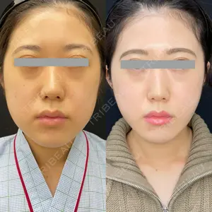 渋谷美容外科クリニック 新橋院 藏薗 侑人医師の症例
