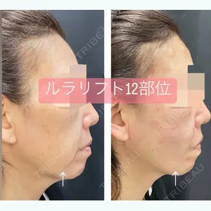 ルラ美容クリニック 新宿院 高木 欽之医師の症例