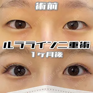 ルラ美容クリニック 神戸院 小海 元医師の症例