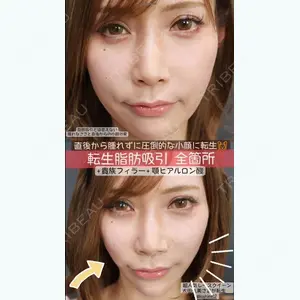 SK新宿歌舞伎町美容外科・歯科の症例