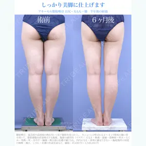 湘南美容クリニック 新宿本院 須田 陽一医師の症例