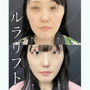 ルラ美容クリニック 渋谷本院 武内 大医師の症例