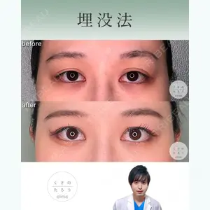 くさのたろうクリニック 藤橋　政尭医師の症例