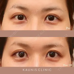 KAUNIS CLINIC（カウニスクリニック） 高野 敏郎医師の症例