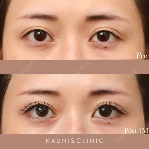 KAUNIS CLINIC（カウニスクリニック） 高野 敏郎医師の症例