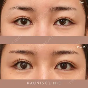 KAUNIS CLINIC（カウニスクリニック） 高野 敏郎医師の症例