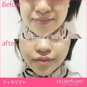 フィラークリニック 新宿院の症例
