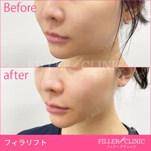 フィラークリニック 新宿院の症例
