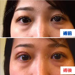 日比谷セントラルクリニック ユウヤ医師の症例