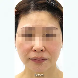 MIYAフェイスクリニック 宮里 裕医師の症例