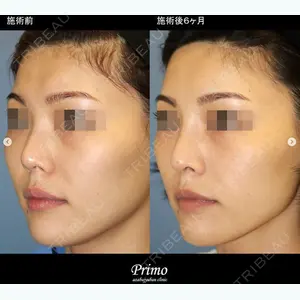 プリモ麻布十番クリニック 大場教弘医師の症例