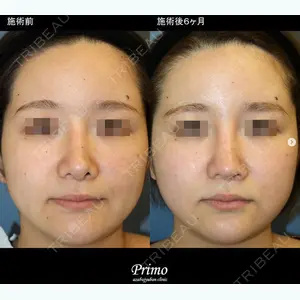 プリモ麻布十番クリニックの症例