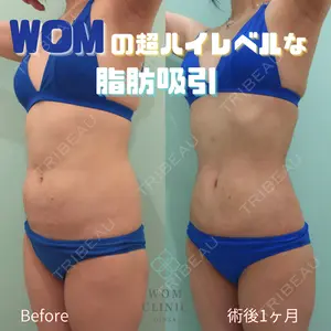 WOM CLINIC GINZA 佐々木 和司医師の症例