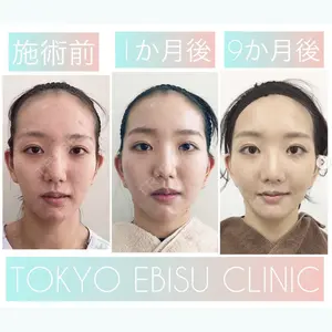東京エビスクリニックの症例