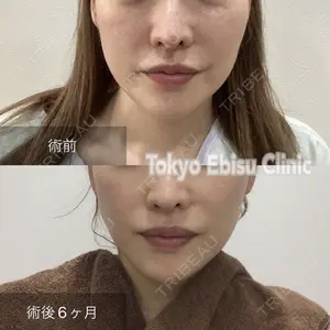 東京エビスクリニックの症例