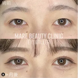 Mare beauty clinic 前波　希映医師の症例