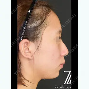 Zetith Beauty Clinic 鉄鑠医師の症例