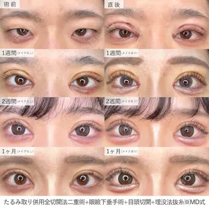 東京シンデレラ美容外科 新宿院 吉原 伯医師の症例