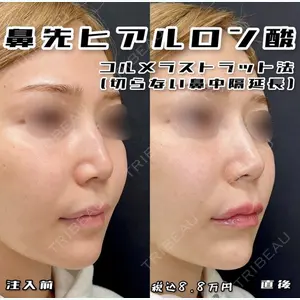 ルラ美容クリニック 神戸院 小海 元医師の症例