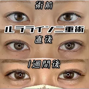 ルラ美容クリニック 神戸院 小海 元医師の症例