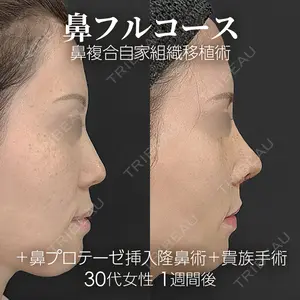ジョウクリニック大阪院 重本　譲医師の症例