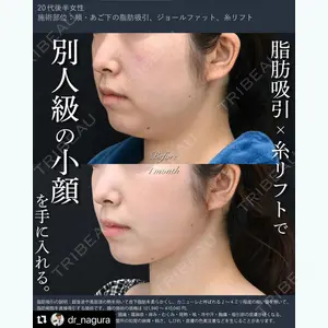 湘南美容クリニック 秋葉原院 名倉 俊輔医師の症例