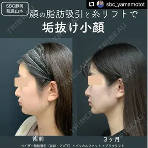 湘南美容クリニック 静岡院 山本 高士医師の症例