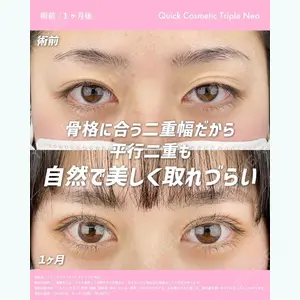 湘南美容クリニック 新宿本院 金 児美医師の症例