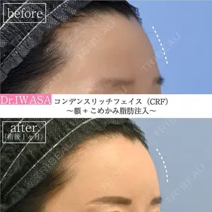 湘南美容クリニック 恵比寿院 岩砂 里美医師の症例