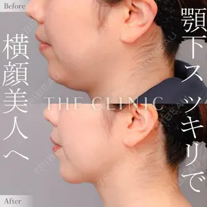 THE CLINIC（ザ・クリニック）東京院 加藤敏次医師の症例