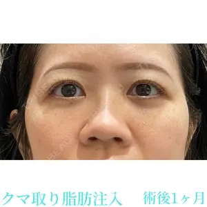 お茶の水美容形成クリニック 吉井 健吾医師の症例