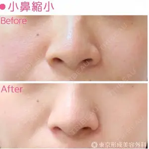 東京形成美容外科 船橋院 弓削田　浩主医師の症例