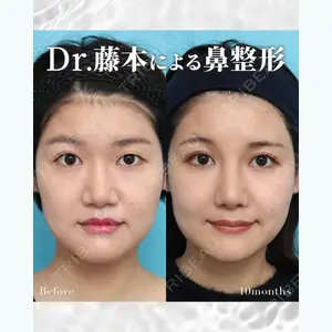ヴェリテクリニック銀座院 藤本 雅史医師の症例
