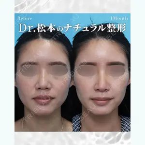 ヴェリテクリニック大阪院 松本 茂医師の症例