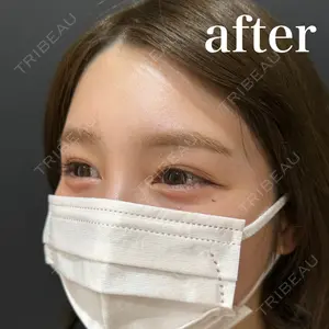 HAAB×DREAM BEAUTY CLINIC 東京本院 田中 優太医師の症例