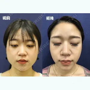 大塚美容形成外科 京都院 緒方慶隆医師の症例