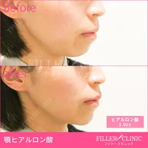 フィラークリニック 大阪なんば院の症例