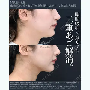 湘南美容クリニック 秋葉原院 名倉 俊輔医師の症例