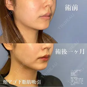 湘南美容クリニック 福岡院 石井 泰医師の症例