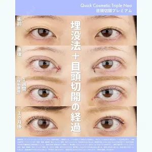 湘南美容クリニック 新宿本院 金 児美医師の症例