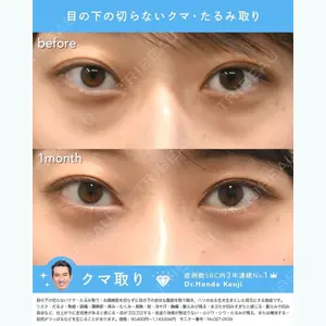 湘南美容クリニック 品川院 本田 賢治医師の症例