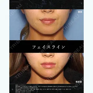 湘南美容クリニック 仙台院 田中 龍二医師の症例