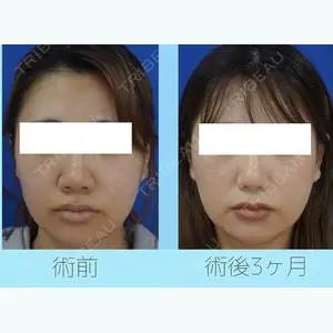 リッツ美容外科 大阪院 志賀　由章医師の症例