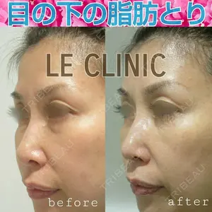 LE CLINIC 喜多　俊博医師の症例
